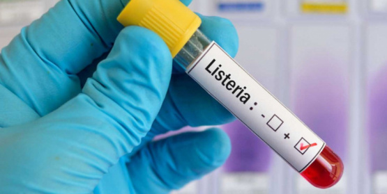 Bacterias lácticas con potencial probiótico y biosanitizante para el control de patógenos alimentarios